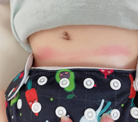 I pannolini lavabili eliminano veramente le irritazioni da pannolino?